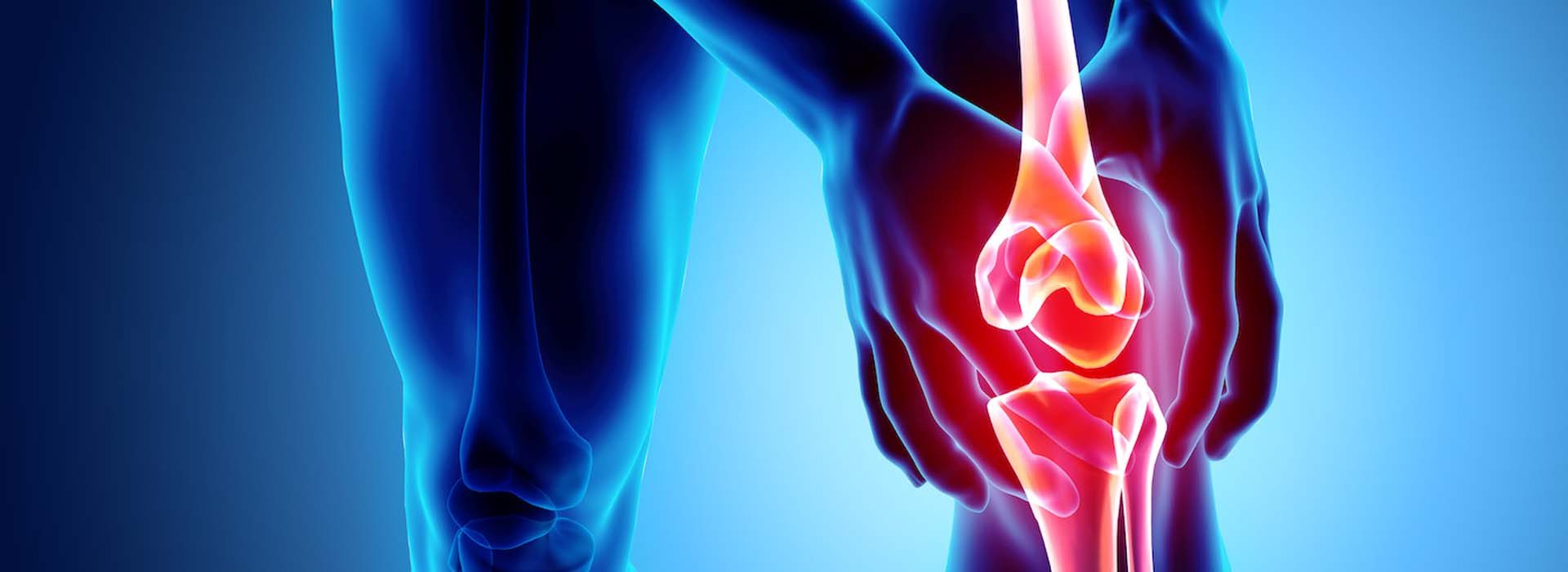 Knee painful - skeleton x-ray, 3D Illustration medical concept.